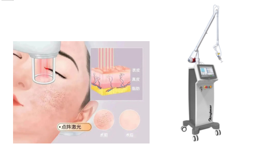 image image.png